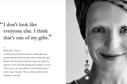 Vogue y qué se siente perder todo tu&nbsp;pelo